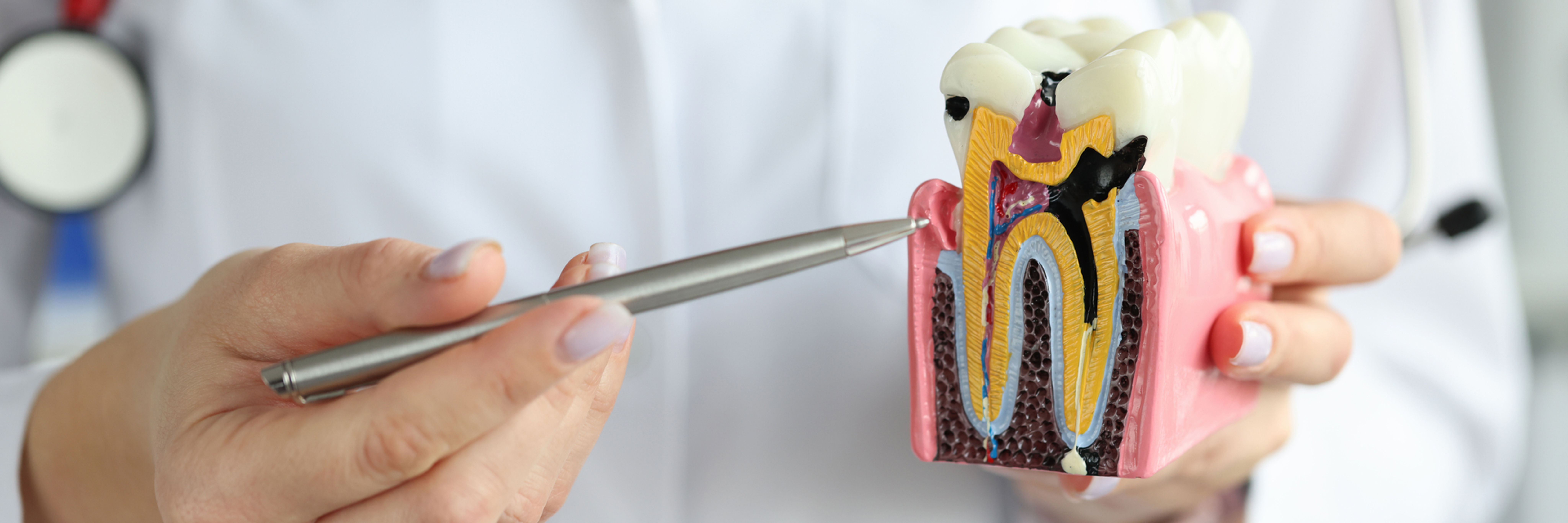 Editorial feature for A Permanent Tooth Replacement to Consider at the Start of the Year