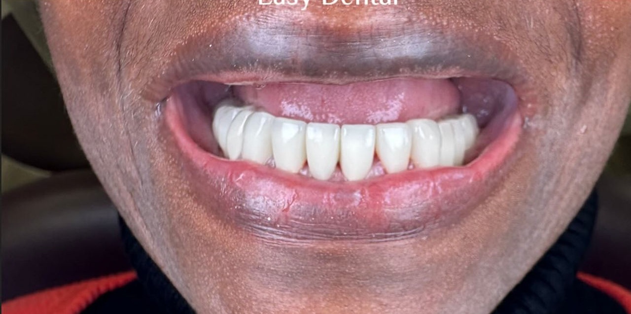 Editorial feature for Got Dental Anxiety? Here’s How to Calm Your Nerves for Good