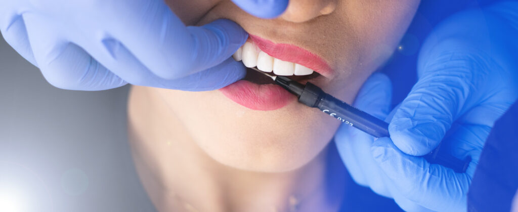 Porcelain Crowns in West Orange, NJ: Durable, Natural-Looking Restorations