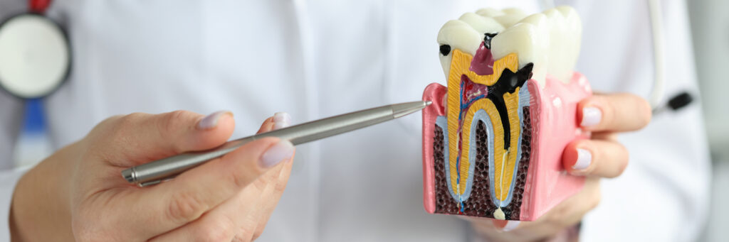 Bone Grafting
