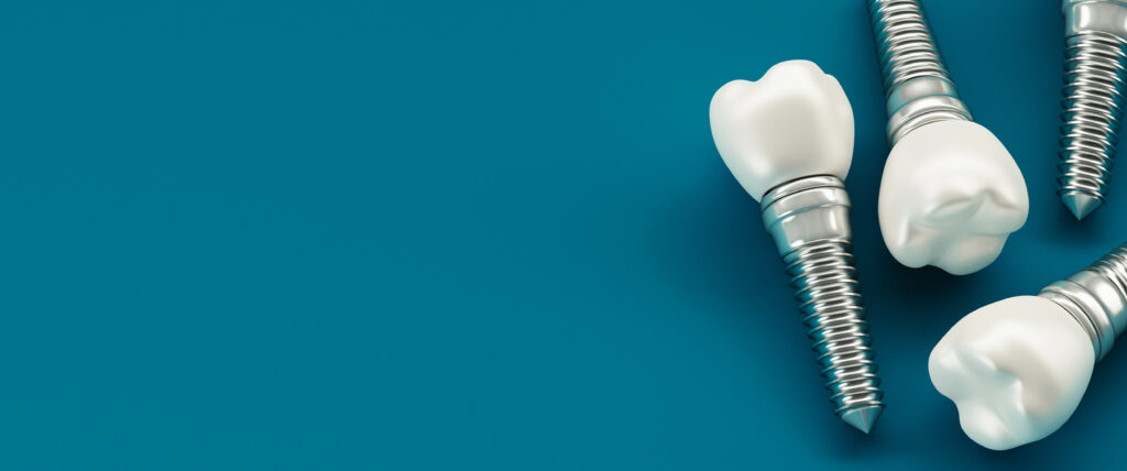 Single Tooth Implant