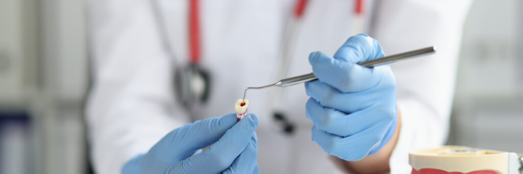 Tooth Extraction