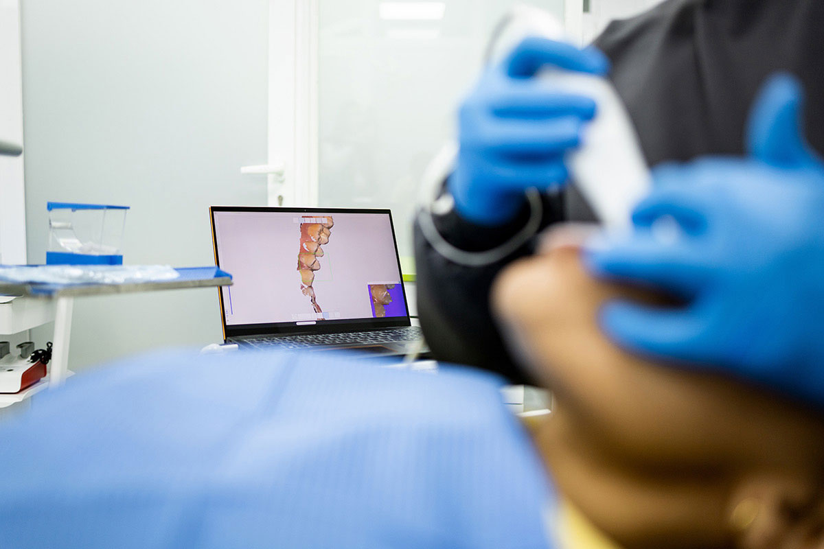7 Signs You May Need a Full Mouth Restoration in West Orange, NJ