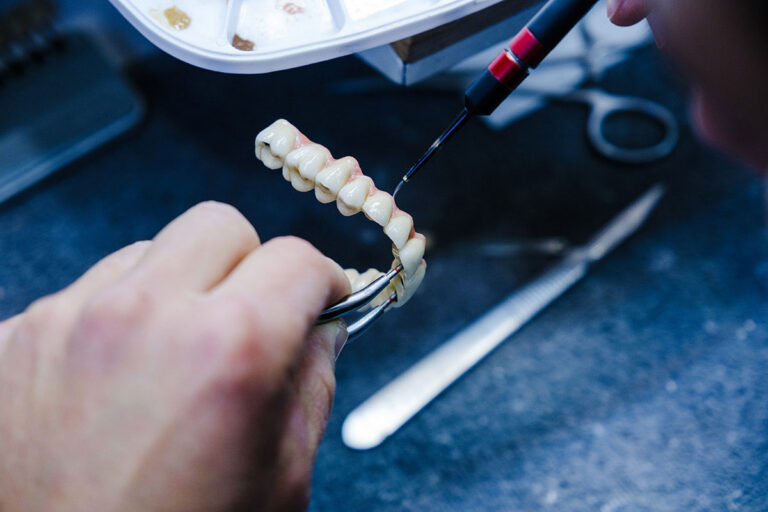 Implant-Supported Dentures vs Traditional Dentures: Which Is Right for You?